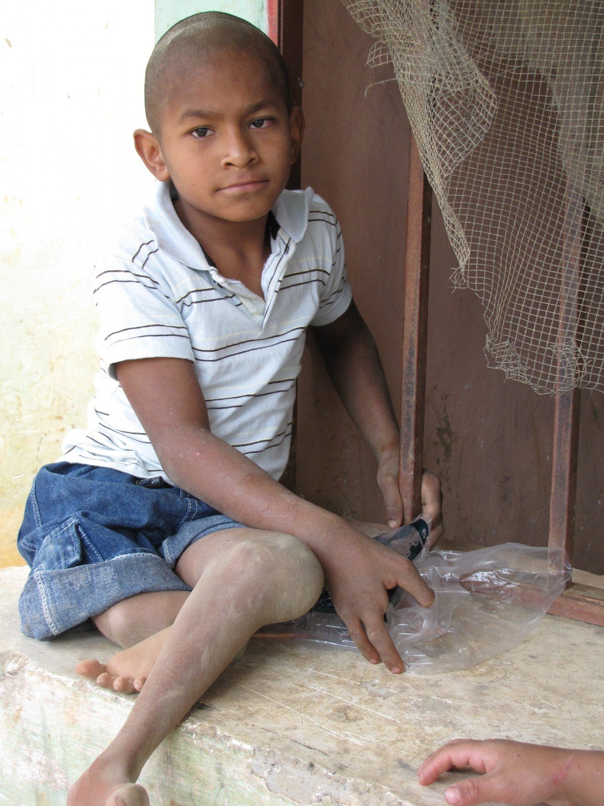 A beggar child in Honduras